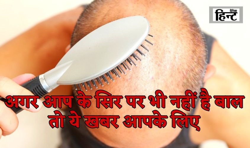 Hyderabad Hair Loss Scam : अगर आप के सिर पर भी नहीं है बाल तो ये खबर आपके लिए, सिर पर बाल आने का लालच देकर लोगों से ठगे लाखों रूपए